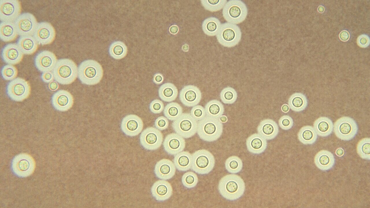 Cryptococcus neoformans, a pathogenic fungus, under India ink staining. Photo: CDC / Dr. Leanor Haley (PHIL 3771), public domain, via Wikimedia Commons.
