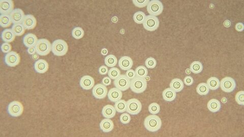Cryptococcus neoformans, a pathogenic fungus, under India ink staining. Photo: CDC / Dr. Leanor Haley (PHIL 3771), public domain, via Wikimedia Commons.