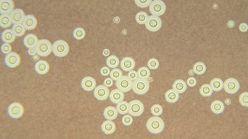 Cryptococcus neoformans, a pathogenic fungus, under India ink staining. Photo: CDC / Dr. Leanor Haley (PHIL 3771), public domain, via Wikimedia Commons.